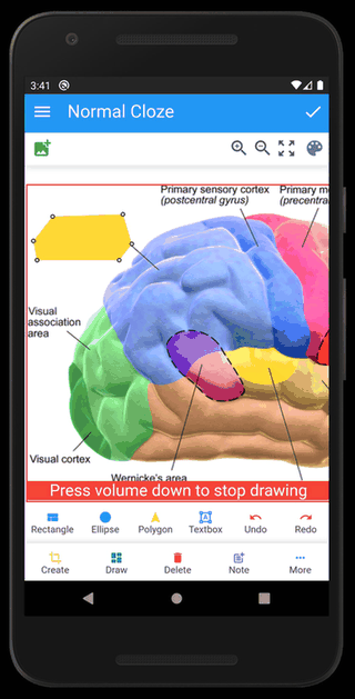 Anki Image Occlusion screenshot